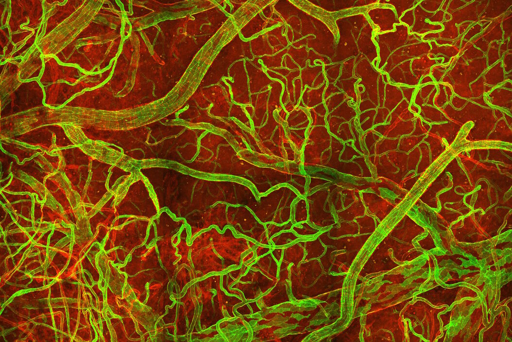 In vivo imaging of a mouse pial and cortical vasculature through a glass window (ROSAmT/mG::Pdgfb-CreERT2 mouse meningeal and cortical visualization following tamoxifen induction and craniotomy). Courtesy: Thomas Mathivet, PhD Mouse_pial_and_cortical_vasculature.jpg
