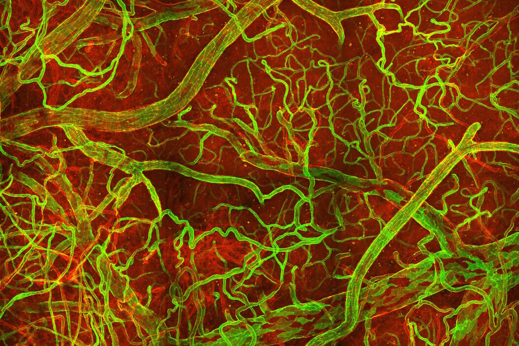 [Translate to chinese:] In vivo imaging of a mouse pial and cortical vasculature through a glass window (ROSAmT/mG::Pdgfb-CreERT2 mouse meningeal and cortical visualization following tamoxifen induction and craniotomy). Courtesy: Thomas Mathivet, PhD Mouse_pial_and_cortical_vasculature.jpg