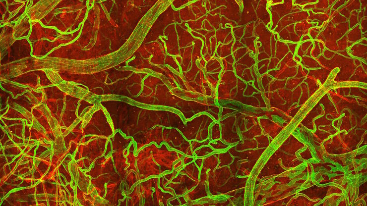 In vivo imaging of a mouse pial and cortical vasculature through a glass window (ROSAmT/mG::Pdgfb-CreERT2 mouse meningeal and cortical visualization following tamoxifen induction and craniotomy). Courtesy: Thomas Mathivet, PhD