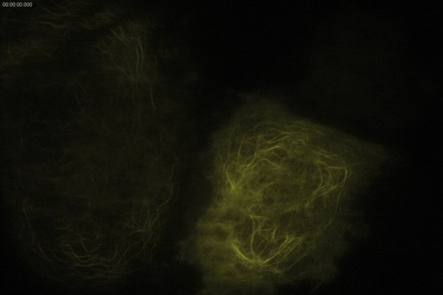 TIRF Image of Tubulin, YFP, penetration depth: 120 mm