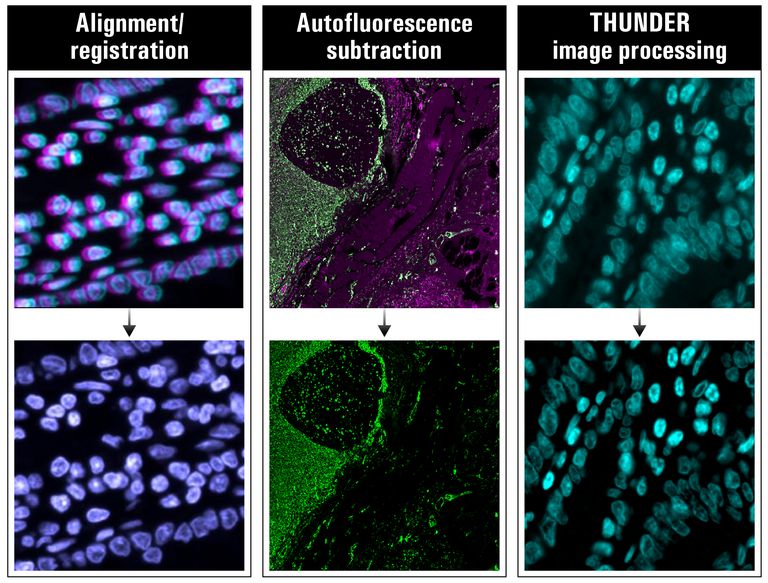 Examples of alignment/registration, autofluorescence subtraction, and THUNDER image processing before (top) and after (bottom) correction.
