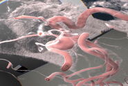 Analysis of an aneurysm with Virtual Reality. Image courtesy of Prof. Raphael Guzman.