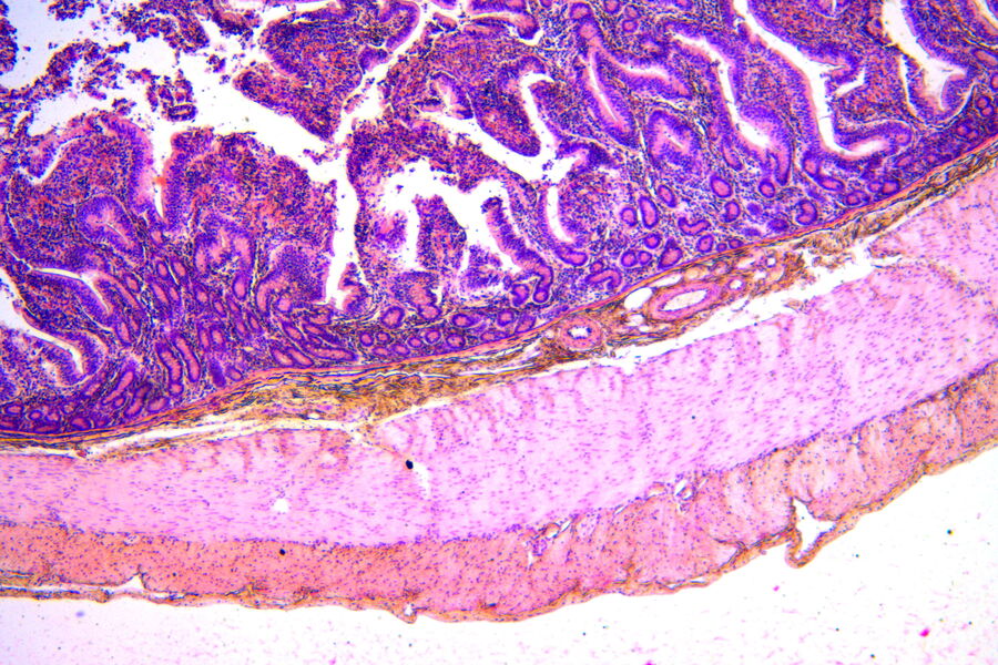 This 40x magnification of a duodenum shows the boundary between the submucosal and mucosal regions