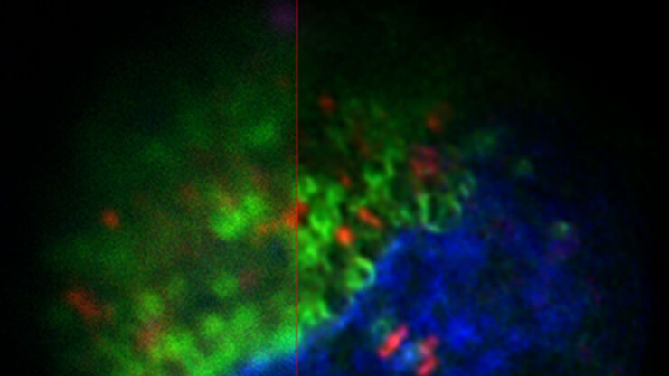 [Translate to chinese:] Projection of a confocal z-stack. Sum159 cells, human breast cancer cells kindly provided by Ievgeniia Zagoriy, Mahamid Group, EMBL Heidelberg, Germany. Blue–Hoechst - indicates nuclei, Green–MitoTracker mitochondria, and red–Bodipy - lipid droplets