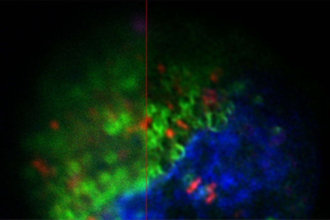 Projection of a confocal z-stack. Sum159 cells, human breast cancer cells kindly provided by Ievgeniia Zagoriy, Mahamid Group, EMBL Heidelberg, Germany. Blue–Hoechst - indicates nuclei, Green–MitoTracker mitochondria, and red–Bodipy - lipid droplets Keyvisual-Cancer-cell-under-Cryo_Coral-Cryo_TechNote.jpg