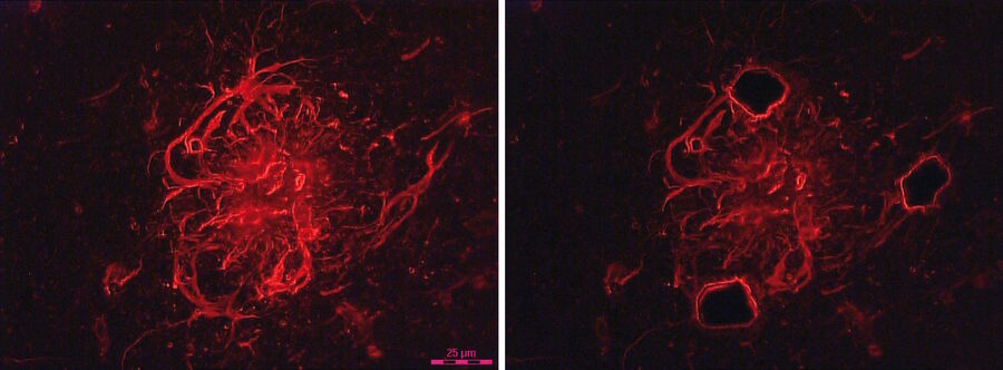 Fig. 2: Brain, frozen section of GFAP-immunopositive astrocytes – before and after laser microdissction. Courtesy of G.J. Burbach, MD, and T. Deller, MD, Institute of Clinical Neuroanatomy, J.W. Goethe University, Frankfurt, Germany.