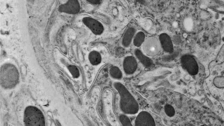 Kidney, rat. Courtesy of L. Edelmann, University Hamburg, Germany. 
