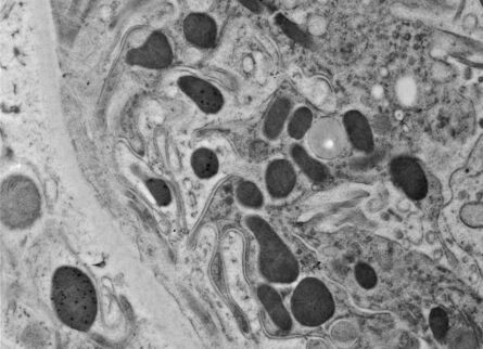 Kidney, rat.
