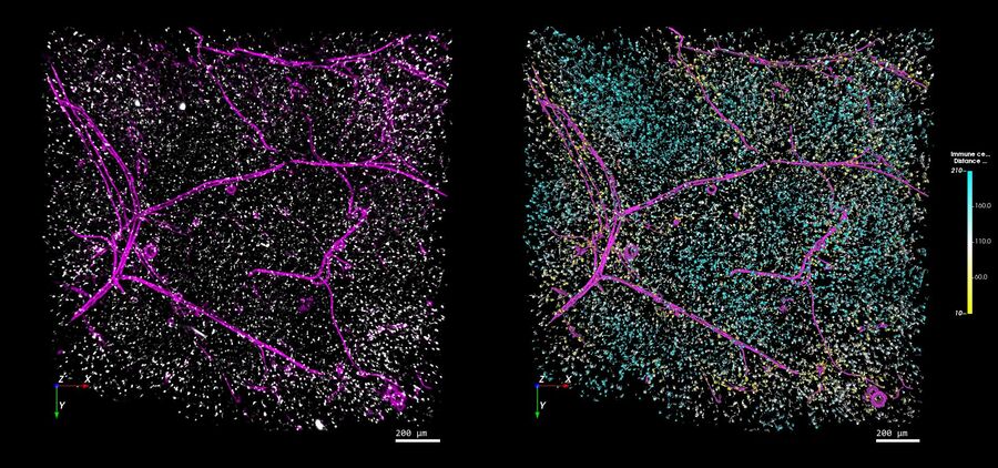 Left-hand image: The distribution of immune cells (white) and blood vessels (pink) in white adipose tissue (image captured using the THUNDER Imager 3D Cell Culture). Right-hand image: The same image after automated analysis using Aivia, with each immune cell color-coded based on its distance to the nearest blood vessel. Image courtesy of Dr. Selina Keppler, Munich, Germany.