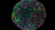 Spheroid stained with Cyan: Dapi nuclear countertain; Green AF488 Involucrin; Orange AF55 Phalloidin Actin; Magenta AF647 CK14.