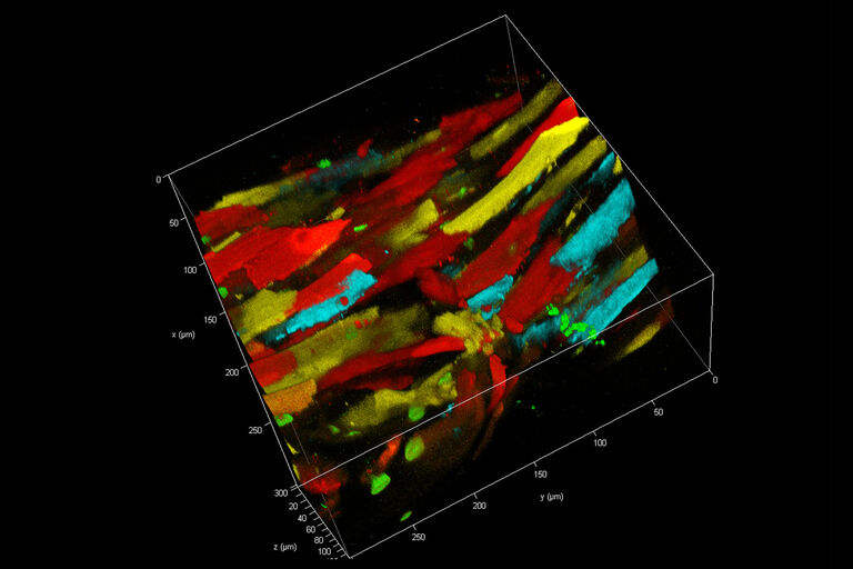 Córtex cerebral de camundongo vivo com neurônios (GFP, em verde) e microglia (YFP, em amarelo) geneticamente marcados, astrócitos marcados com sulforodamina (em azul) e o vaso sanguíneo corado pela injeção de Alexa680-Dextran na veia da cauda (em vermelho). A pilha inteira é ~ 250 x 250 x 250 µm. Amostra de cortesia de LMF no DZNE Bonn, Alemanha.