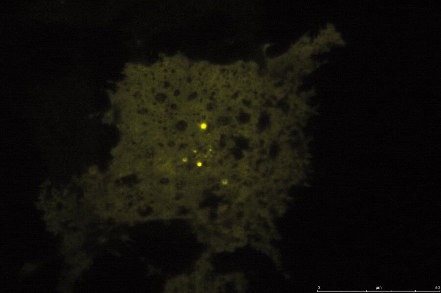 TIRF image of Tubulin CFP. Courtesy of: Prof. Dr. R. Jacob, University Marburg, Department of Clinical Cytobiology and Cytopathology, Marburg, Germany