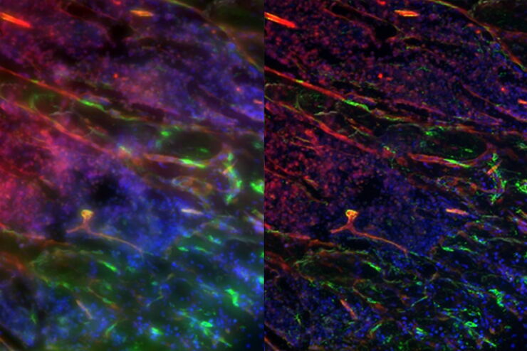 Maximum intensity projection of undecalcified mouse bone tissue expressing GFP (green) and tdTomato (red) and stained with Hoechst 33342 (blue). Imaged using a THUNDER Imager Tissue: A) raw data and B) with ICC.