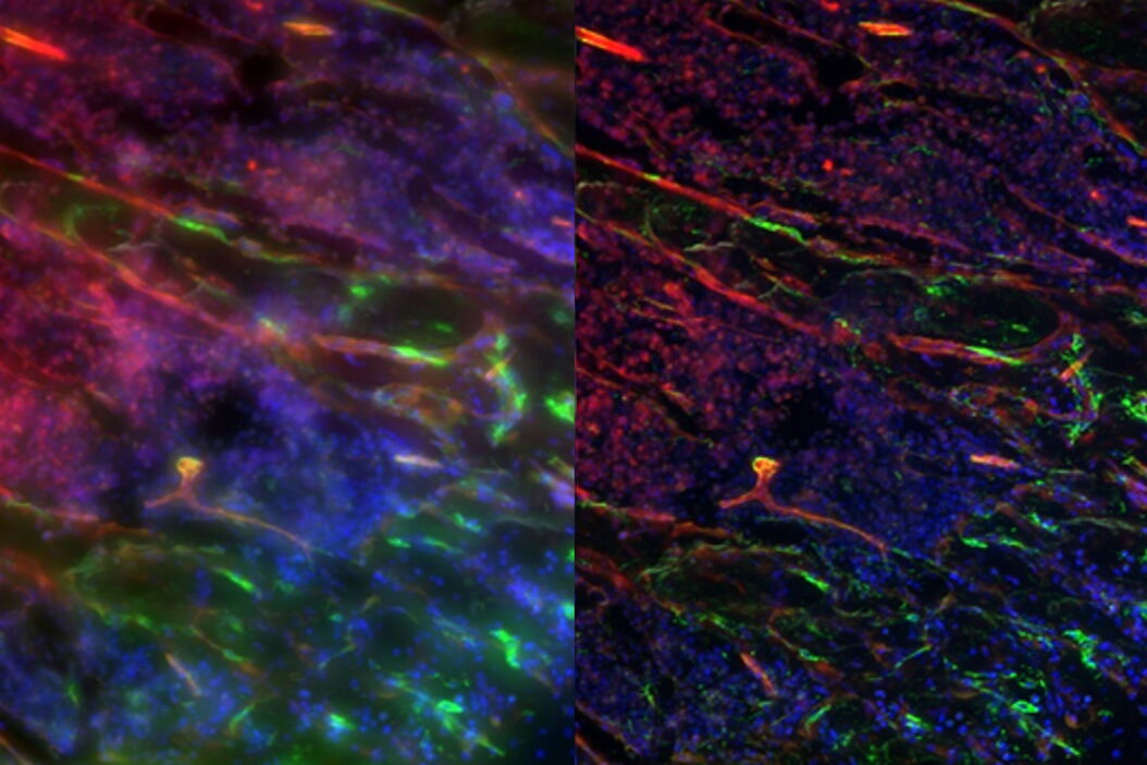 Maximum intensity projection of undecalcified mouse bone tissue expressing GFP (green) and tdTomato (red) and stained with Hoechst 33342 (blue). Imaged using a THUNDER Imager Tissue: A) raw data and B) with ICC. Localizing_Bone_Stem_Cells_In_Vivo_teaser.jpg
