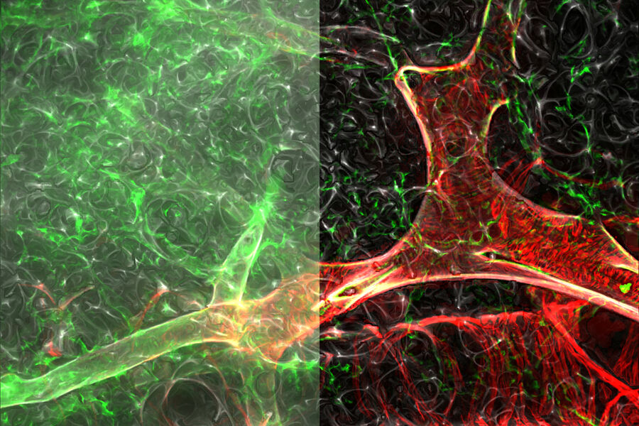 Mouse lung - THUNDER Imager Tissue