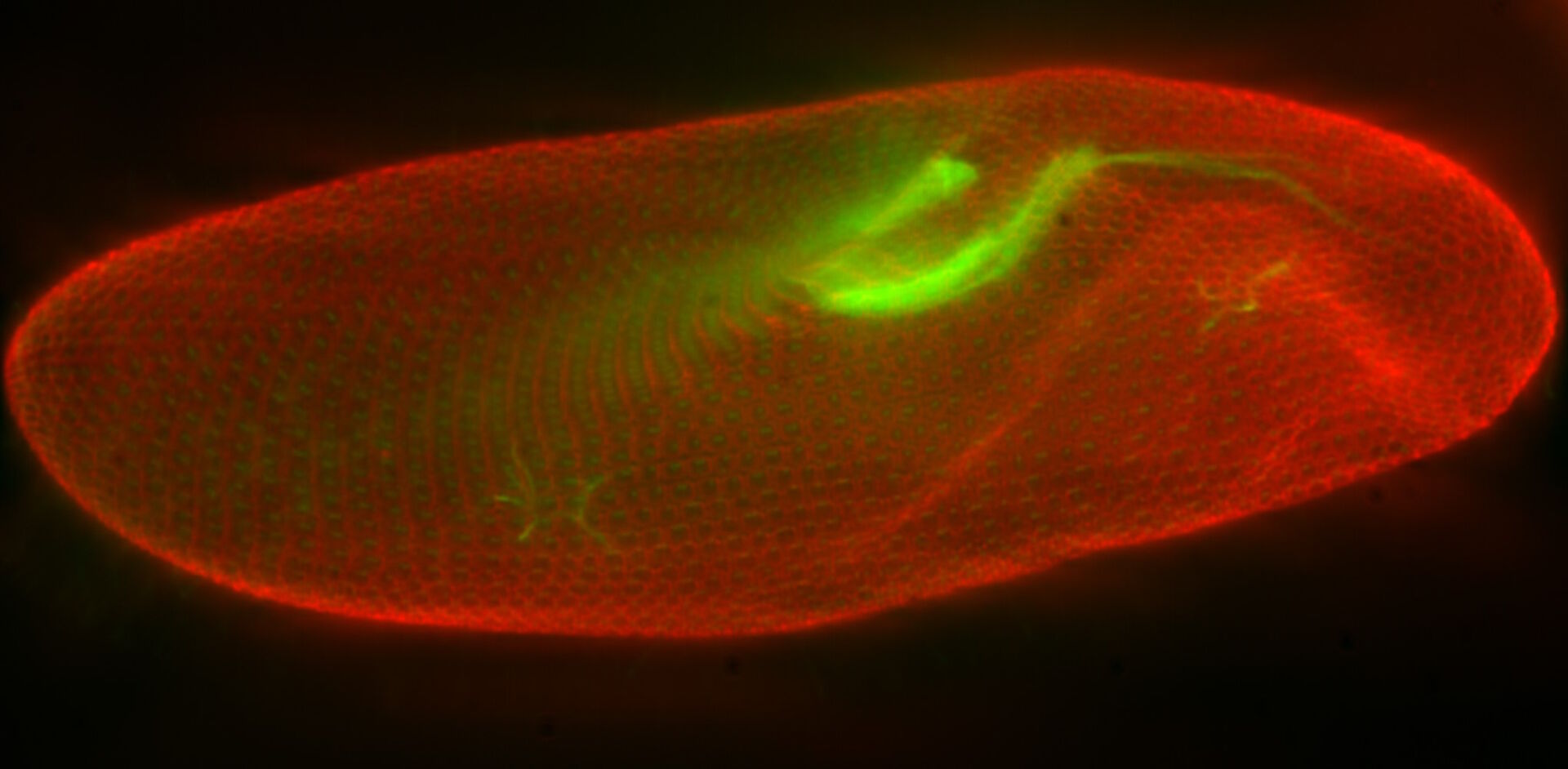 Widefield fluorescence microscope image of a paramecium before computational clearing.