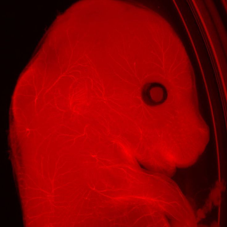 Neurofilaments stained in red to assess neuronal outgrowth in an E12-14 mouse. The mouse was uncleared. Courtesy of Y. Lutz, Centre d’imagerie, IGBMC, France.