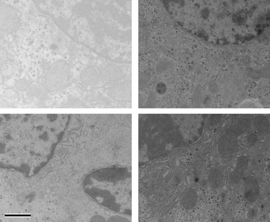 Results from the manual poststaining procedure with UA, OTE, and Pt Blue