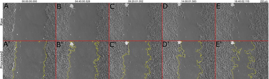 Images of SMCs during wound healing. 