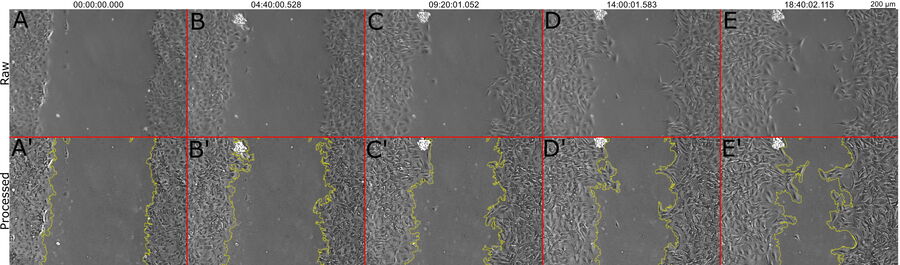 Images of SMCs during wound healing. 