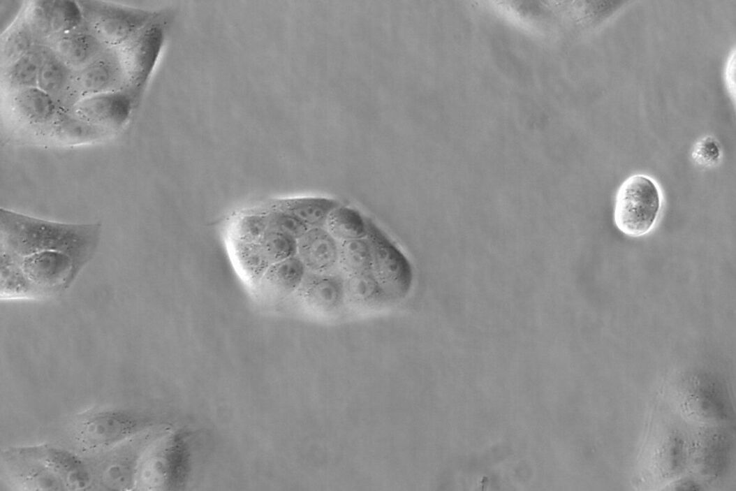 Image of MDCK (Madin-Darby canine kidney) cells taken with phase contrast. MDCK_cells_in_phase_contrast.jpg