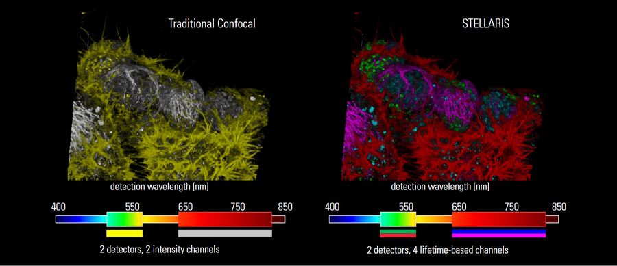 NE-115 cells expressing LifeAct-mNeonGreen, and labeled with Mitotracker Green, NuC Red and SiR-tubulin. Courtesy: Max Heider, University of Bern and Spirochrome. The photons of the two intensity images (top image) are assigned to the corresponding specie using TauSeparation (bottom image). The four fluorophores (LifeAct-mNeon Green- Red, MitoTracker Green -Green and NucRed –Cyan, SiR Tubulin – Magenta) are acquired with only two detectors and are separated using TauSeparation even when their intensities overlap.