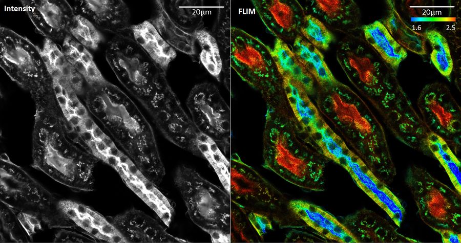 Kidney slice (FluoCells®) where the cell membranes are stained with WGA-Alexa Fluor488. The lifetime contrast (right, color bar scale is lifetime in nanoseconds) indicates that the membranes are located in micro-environmental conditions with different pH values or ion concentrations.