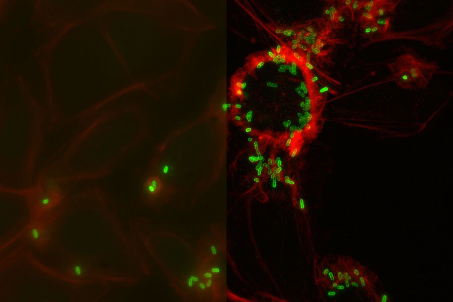 Infected MDCK epithelial cells - THUNDER Imager