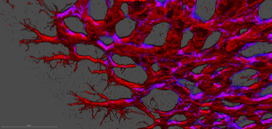 3D reconstruction of confocal stacks showing the angiogenic sprouting front area of a Wt retina at postnatal day 7. 