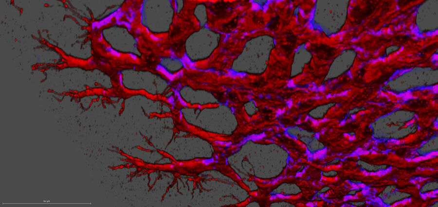 3D reconstruction of confocal stacks showing the angiogenic sprouting front area of a Wt retina at postnatal day 7. 3D reconstruction of confocal stacks showing the angiogenic sprouting front area of a Wt retina at postnatal day 7.