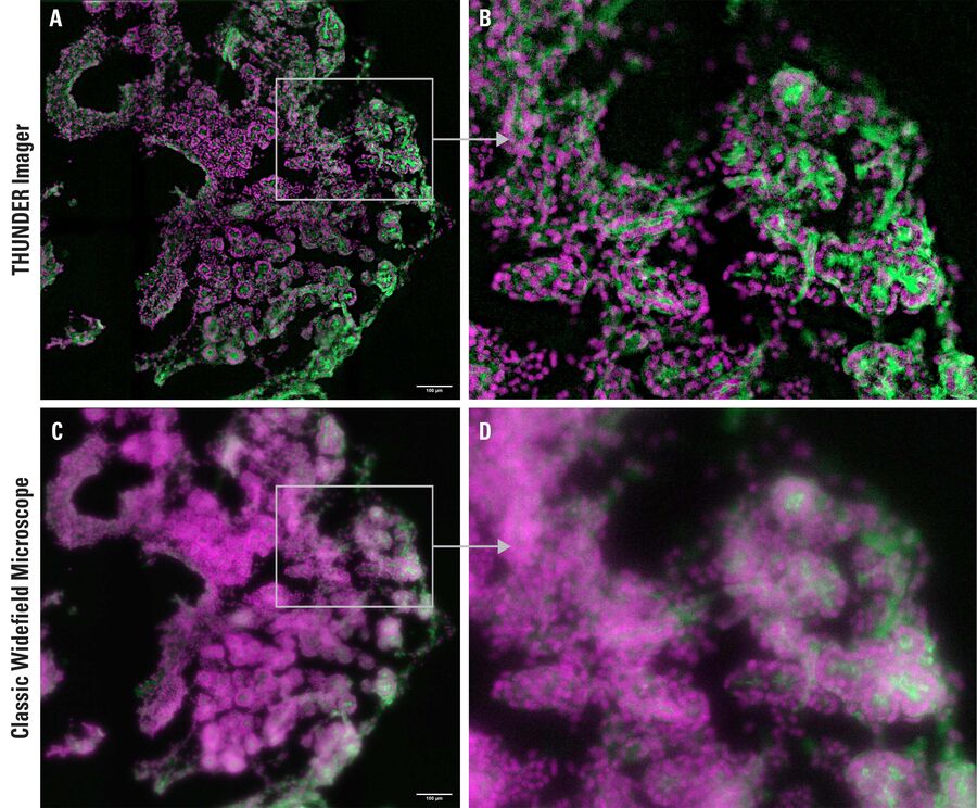 Figure 1: The illustration shows images of the clarified embryonic mouse pancreas explants (E15.5). The cell nuclei (DAPI, magenta) and the cell skeleton (phalloidin-488, green) are marked. A+C A comparison of the "post-THUNDER" (A) and "pre-THUNDER" (C) data clearly visualizes the contrast enhancement on the individual image plane. B+C Magnification view of the 20 µm thick pancreas section.