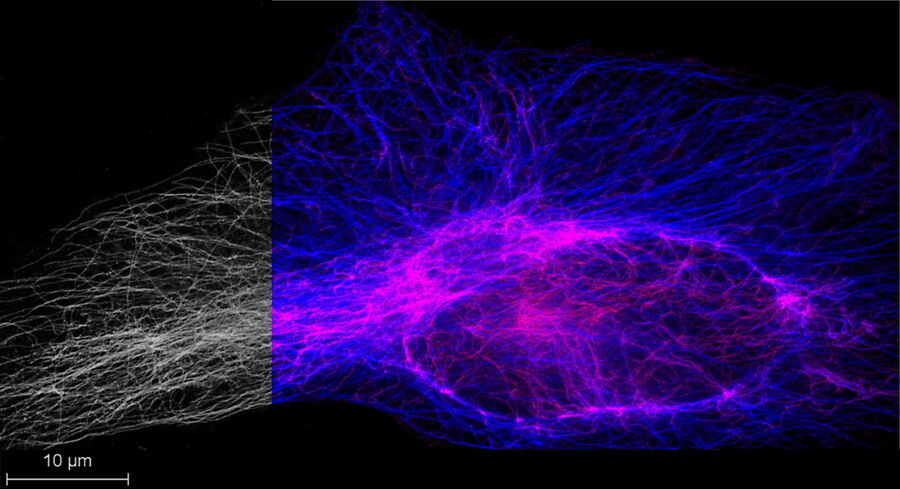 Multi-fluorophore STED-FALCON imaging of cell cytoskeleton. 