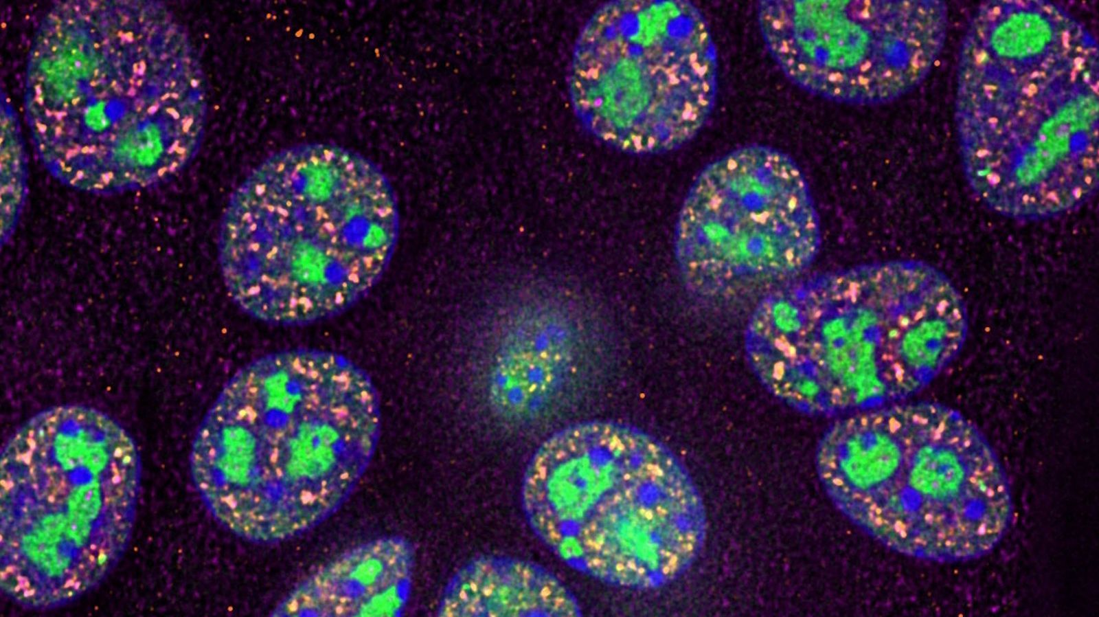 Immortalised mouse pancreatic epithelial cells labelled with DAPI (blue), JF azide dye (shown in green), Alexa 647 (pink) and A555 (yellow) to stain various RNA bio-genesis sub nuclear compartments, here mainly nucleoli (rRNA synthesis) and nuclear speckles (RNA splicing regulatory units). Image acquired using a 100x oil immersion objective on the THUNDER Imager Cell, without (left) and with (right) THUNDER computational clearing applied. Courtesy of Dr. Zeinab Rekad, Department of Biochemistry, University of Oxford.