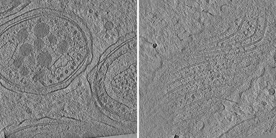 Cryo-electron tomography of malaria parasites within a cryo-FIB-prepared lamella, acquired on a Titan Krios transmission electron microscope. The tomographic reconstruction reveals membrane organization and internal structural features, linking fluorescence-guided targeting with high-resolution information from the preserved tissue context.