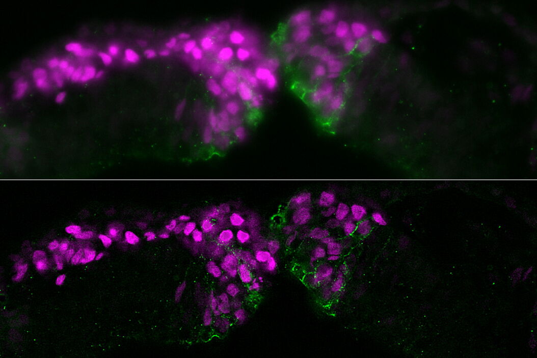 Chicken-embryo cross section at the level of the midbrain showing neural crest cells and cadherin-6B molecules. Raw widefield data (top) and THUNDER image (bottom). Chicken-embryo_cross_section_midbrain_neural_crest_cells_cadherin-6B_molecules_widefield_THUNDER_teaser.jpg