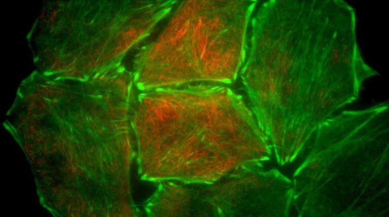 Células HeLa estáveis expressando Actin Chromobody-Tag GFP2 e coloridas com SIR-Tubulin. Cortesia de ChromoTek GmbH, Munich, Alemanha, e Spirochrome SA.