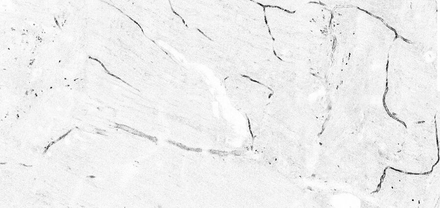 Tile scan of large intestine of an anasthesized mouse. 