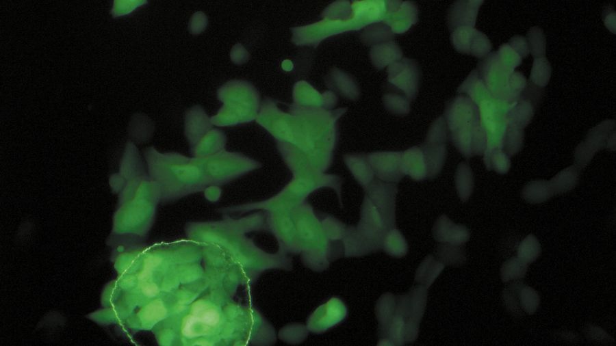 LMD of human foreskin fibroblasts which are infected with human cytomegalo virus expressing the HCMV-GFP fusion protein. 