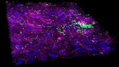 3D human bladder microtissue infected with E.coli. Image acquired using THUNDER Imager Cell Spinning Disk. Courtesy of Dr Ramon Garcia Maset, University of Oxford and University College London (UCL). 