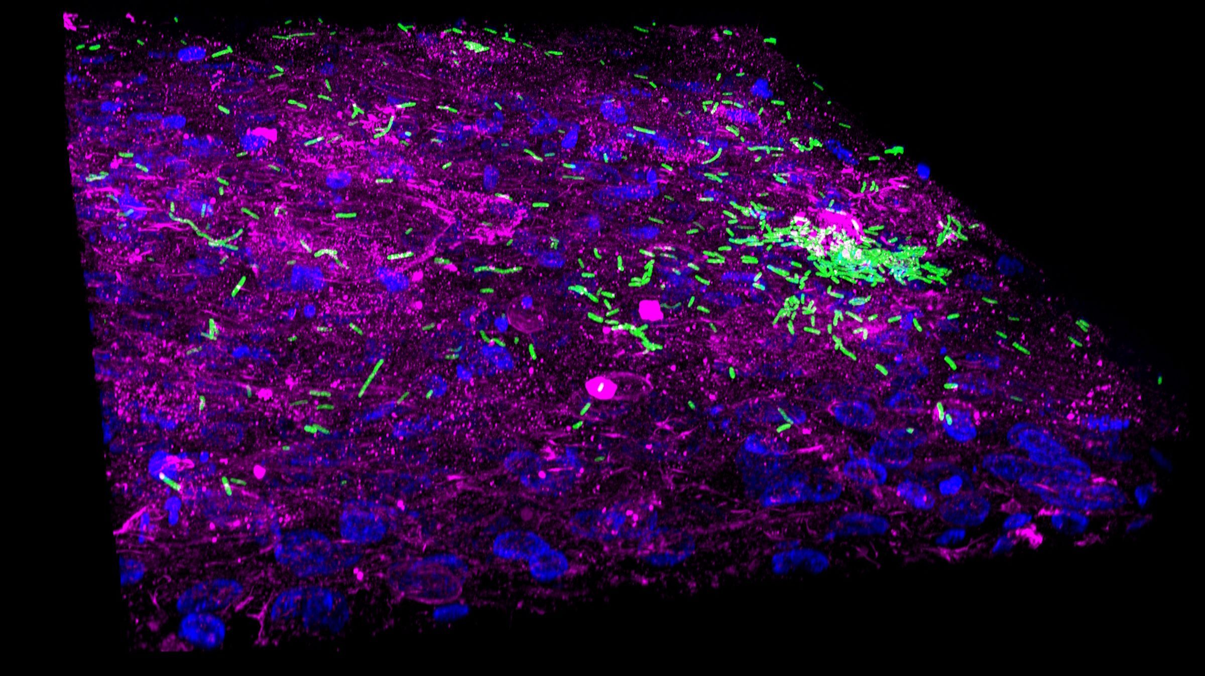 3D human bladder microtissue infected with E.coli. Image acquired using THUNDER Imager Cell Spinning Disk. Courtesy of Dr Ramon Garcia Maset, University of Oxford and University College London (UCL). 