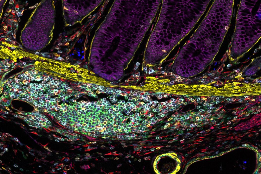  Designing_your_Research_Study_with_Multiplexed_IF_Imaging_teaser.jpg