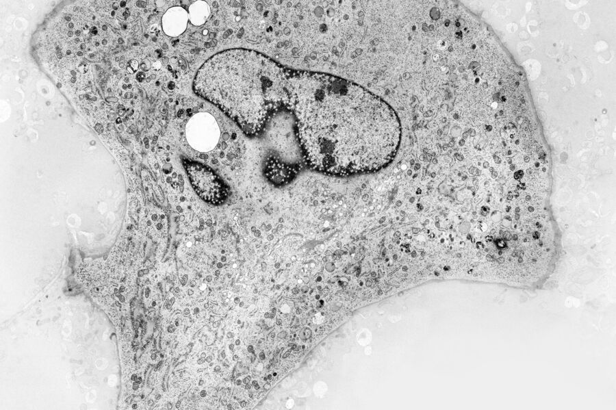 Mouse embryonic fibroblast grown on sapphire disc (courtesy of Verkade P, University of Bristol, UK).