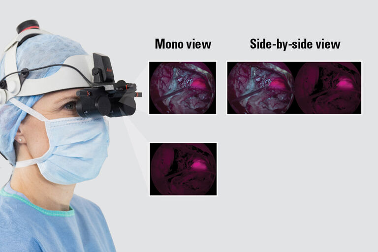 Acceder a un amplio espectro de información quirúrgica en tiempo real en una vista 3D