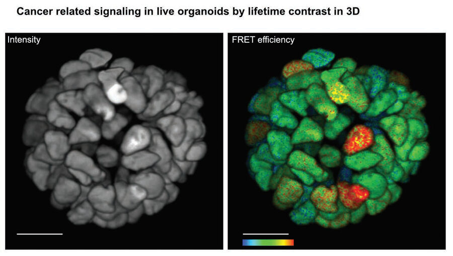 Live 3D FLIM on patient-derived organoid.