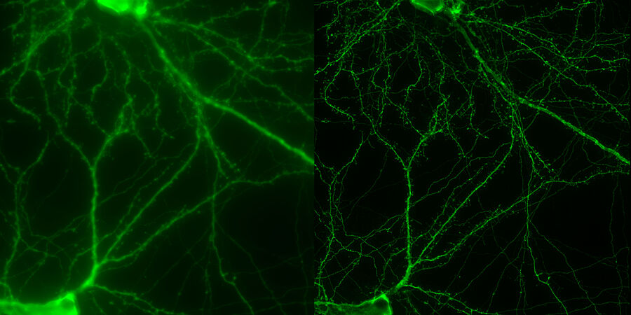 Mouse cortical neuron. Transgenic GFP (green). Image courtesy of Prof. Hui Guo, School of Life Sciences, Central South University, China.