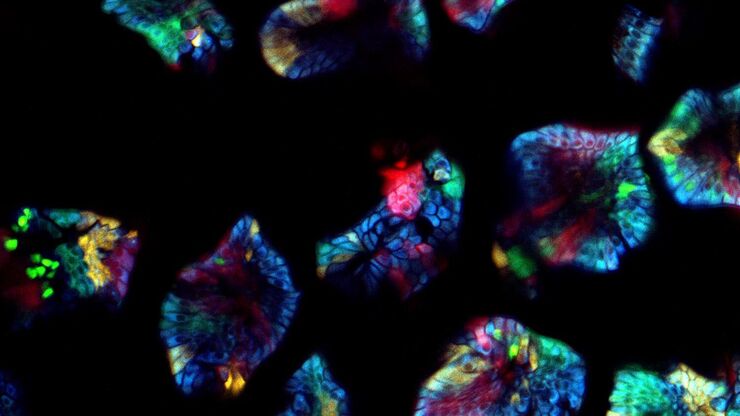 Multicolor image of a Confetti Mouse recorded with the new SP8 DIVE with the 4Tune spectral detector. The adaptation to the transgenic markers allows to achieve more contrast and depth for multi-color in vivo deep imaging. Multicolor image of a Confetti Mouse recorded with the new SP8 DIVE with the 4Tune spectral detector. The adaptation to the transgenic markers allows to achieve more contrast and depth for multi-color in vivo deep imaging. Sample courtesy of Jacco van Rheenen, University of Utrecht, NL.