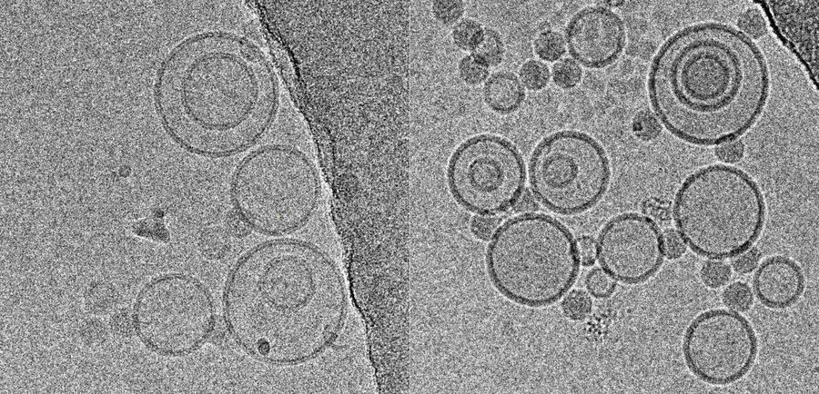 Cryo-electron micrographs of subviral particles of a common cold virus bound to liposomes, acquired under low dose conditions at 300 kV with a CCD-camera. The left image was taken close to focus, yielding higher resolution but more noise, the right image was acquired at higher underfocus (courtesy of Mohit Kumar and Dieter Blaas, MFPL, Vienna/Austria)