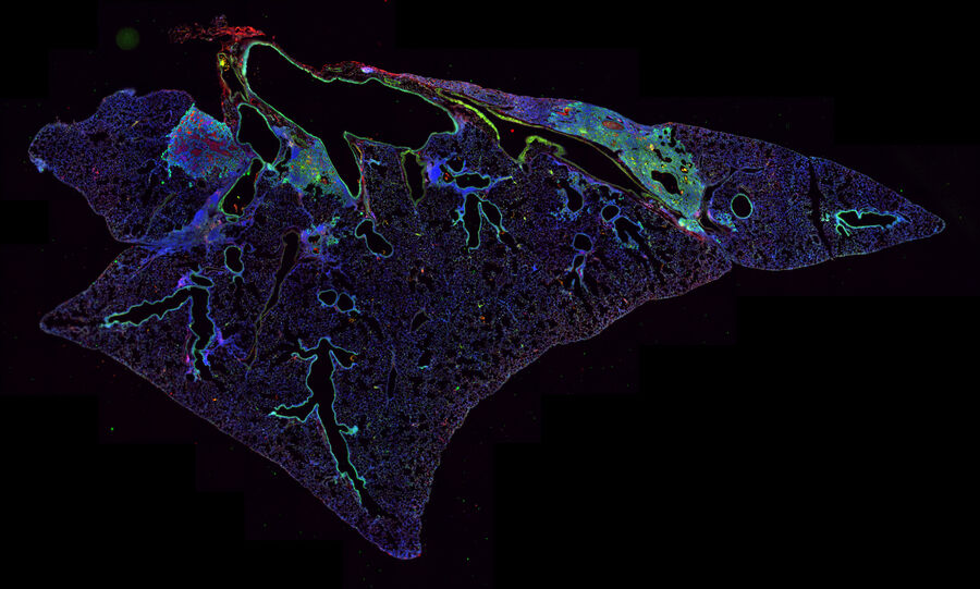 Fig. 4: Immunofluorescence, Keratin-5 (green), PDL-1 (red): Thin section of mouse lung where the mouse was inoculated with the Puerto Rico 8 strain of influenza virus to induce injury to the lung epithelium. Image courtesy of Andrew Beppu, Cedars Sinai Medical Center.