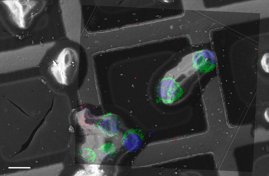 Overlay Confocal 3D with SEM.