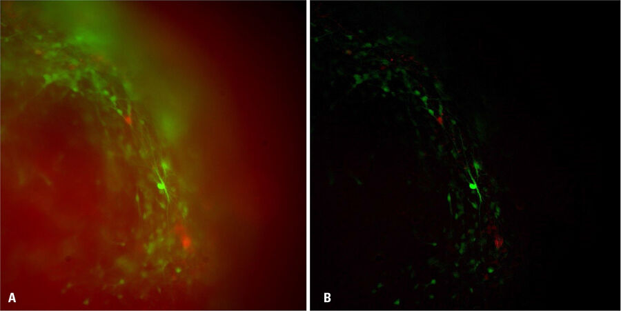 Figure 1: Images of a brain organoid derived from iPSCs acquired with a THUNDER Imager 3D Cell Culture. The cells were infected with the pAAV-hSyn-EGFP and pLX-hGFAP-mCherry virus. The image is the 36th plane cropped out of a 53 plane Z-stack volume. Shown are both the A) raw widefield image and B) the same image after Large Volume Computation Clearing (LVCC). Neurons are labeled in green and astrocytes in red.